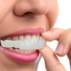 Snap-On Cosmetic Veneers, Upper & Lower