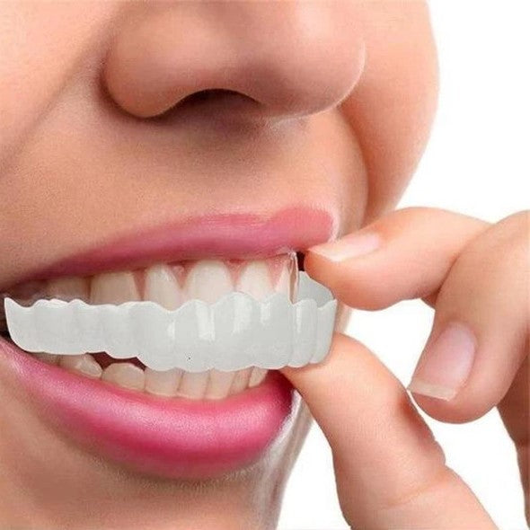 Snap-On Cosmetic Veneers, Upper & Lower