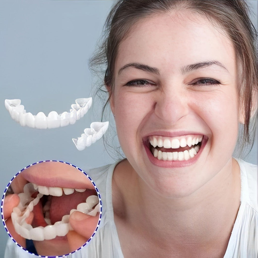 Snap-On Cosmetic Veneers, Upper & Lower
