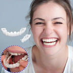 Snap-On Cosmetic Veneers, Upper & Lower