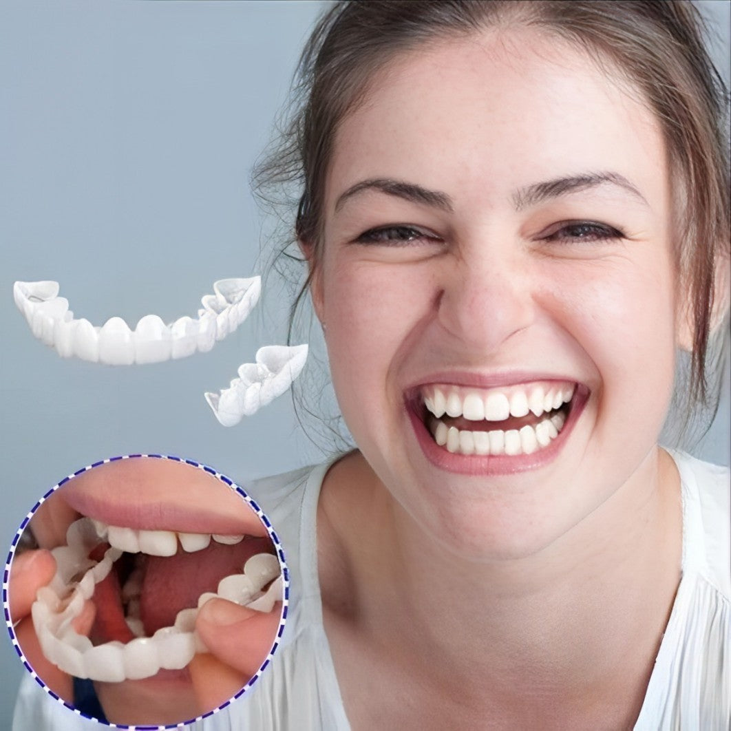 Snap-On Cosmetic Veneers, Upper & Lower