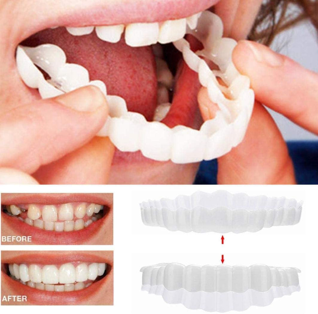 Snap-On Cosmetic Veneers, Upper & Lower