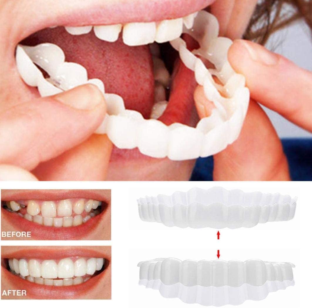 Snap-On Cosmetic Veneers, Upper & Lower