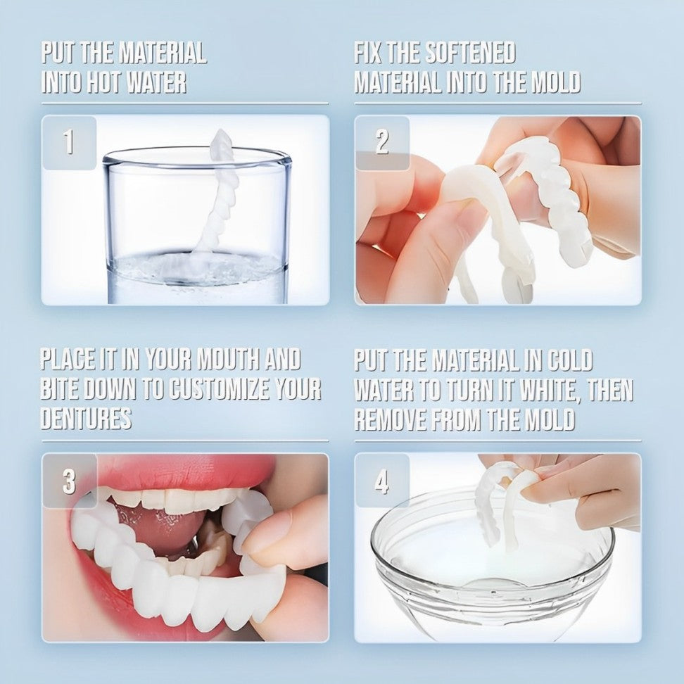 Snap-On Cosmetic Veneers, Upper & Lower