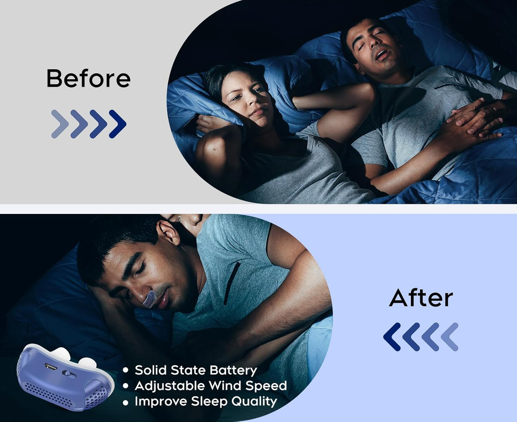 Travel Anti-Snore Airflow Device