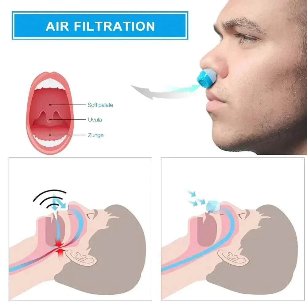Travel Anti-Snore Airflow Device