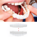Snap-On Cosmetic Veneers, Upper & Lower