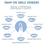 Snap-On Cosmetic Veneers, Upper & Lower