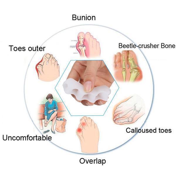 Toe Separator Corrector